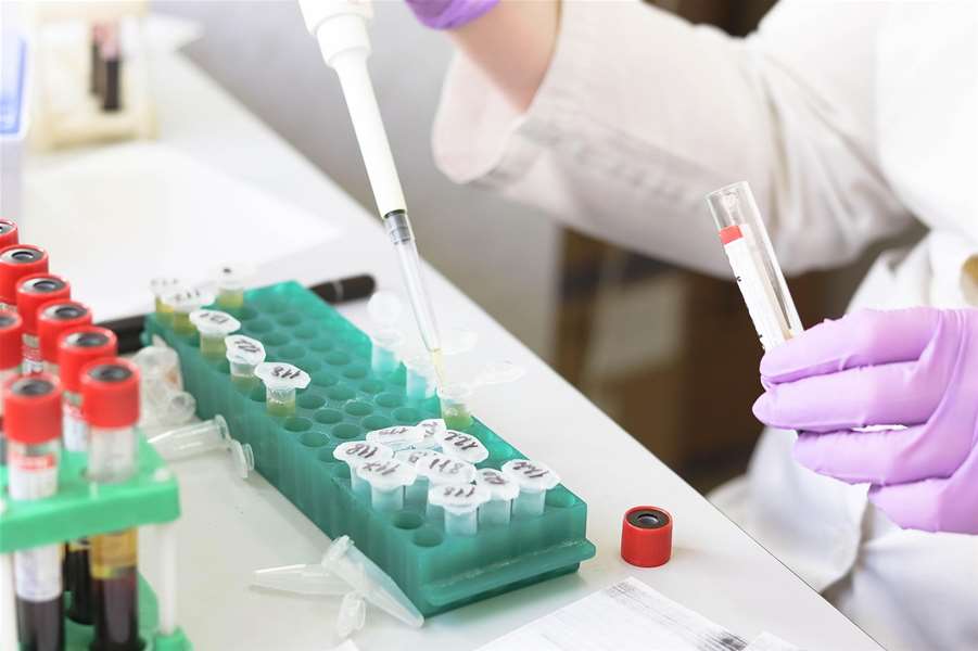 laboratorij-krv