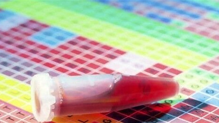 Epruvetica za Luciju