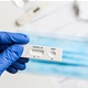 Besplatno brzo antigensko testiranje na SARS-CoV-2 za inozemne turiste u Krapinsko – zagorskoj županiji