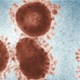 Potvrđen drugi slučaj zaraze koronavirusom u Hrvatskoj