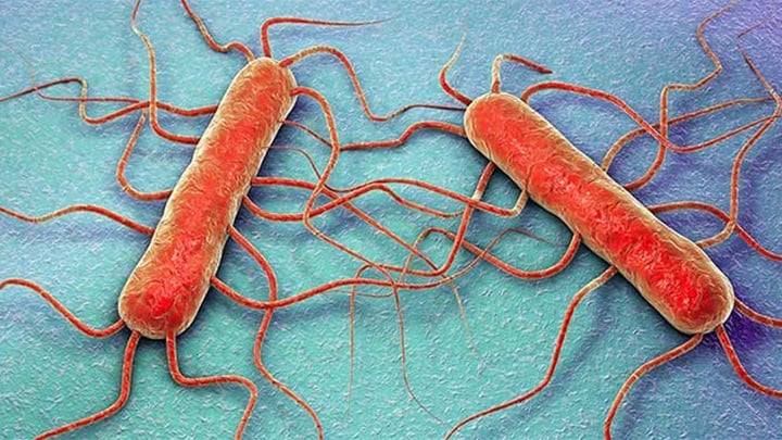 Laboratory-diagnosis-of-Listeriosis-caused-by-Listeria-monocytogenes.jpg